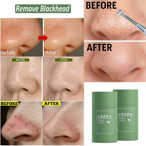 Poreless Deep Cleanse Mask Stick | Blackhead Remover | Works For All Skins Men and Women