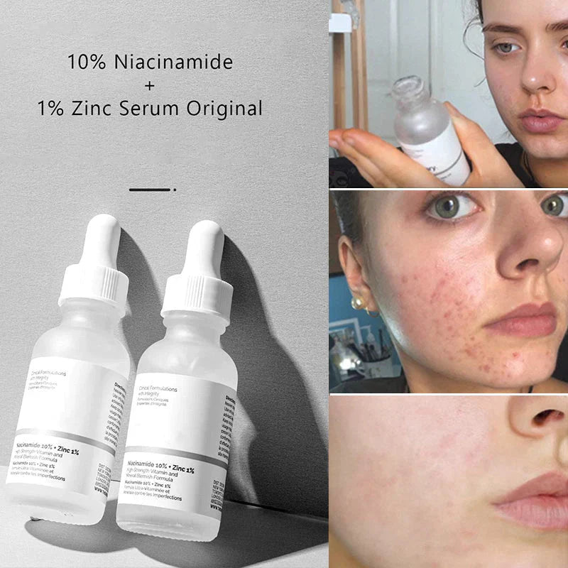 (BUY 1 GET 1 FREE)-THE ORDINARY SERUM | Niacinamide 10% + Zinc 1%